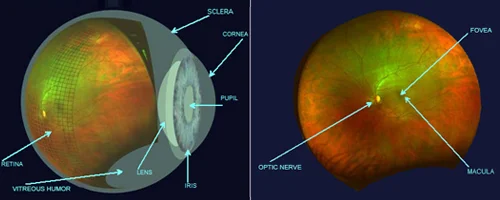 Optomap ultra-widefield retinal imaging at Clairemont Optometry, San Diego, capturing over 80% of the retina for early detection of eye conditions